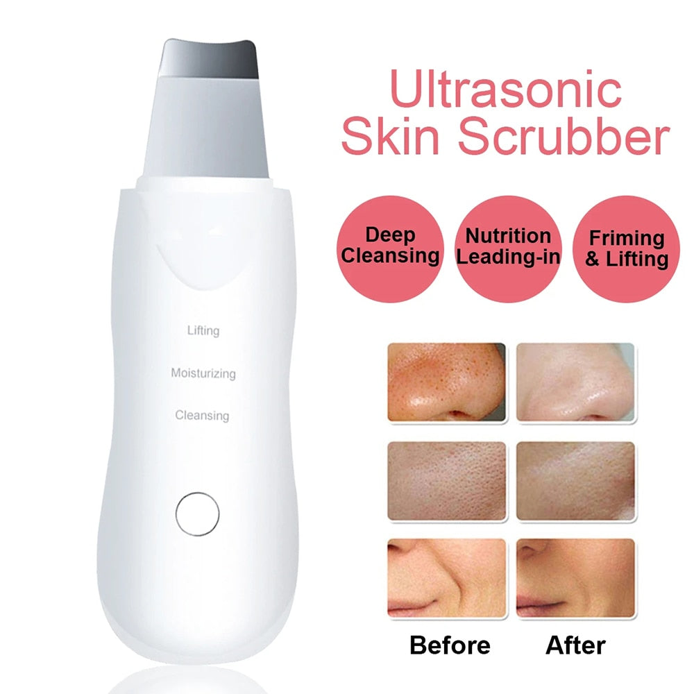 Glimpse Ultrasonic Skin épurateur | Spatule de visage 5 en 1